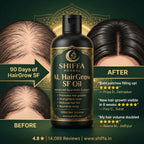 Shiffa Herbal AL-HairGrow SF Oil – Clinically Inspired Ayurvedic Hair Regrowth Oil