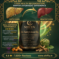 Shiffa Herbal AL-FattyLiver Fix – Herbal Fatty Liver Correction Formula