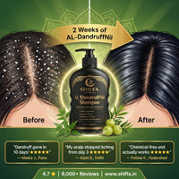 Shiffa Herbal AL-DandruffNil – Herbal Anti-Dandruff & Scalp Cleanser