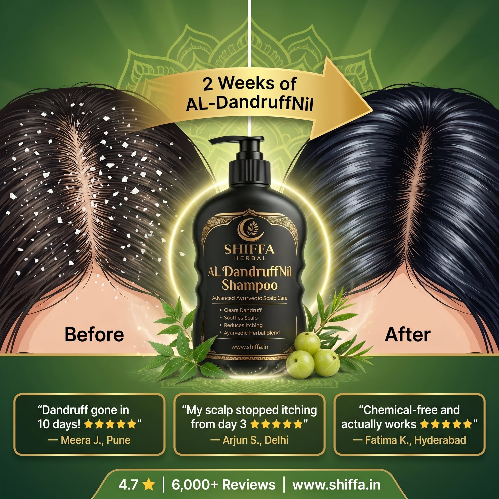 Shiffa Herbal AL-DandruffNil – Herbal Anti-Dandruff & Scalp Cleanser